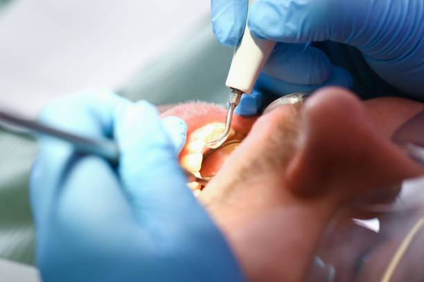 Best Emergency Gum Treatment in Wheelersburg, OH